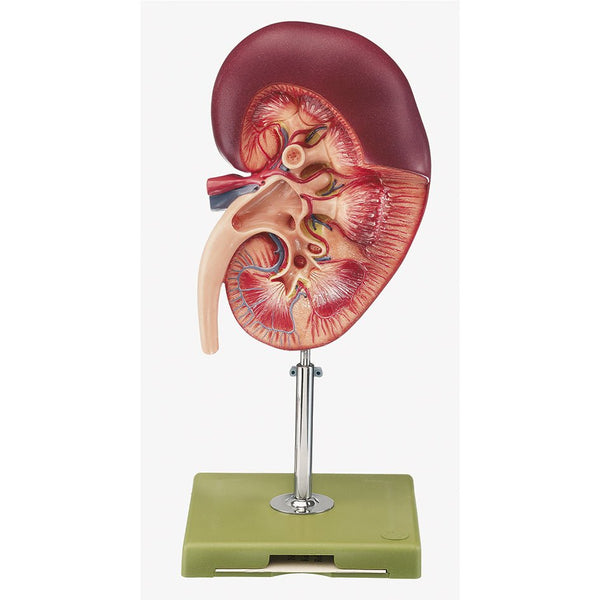 SOMSO Model of Right Kidney – GTSimulators.com