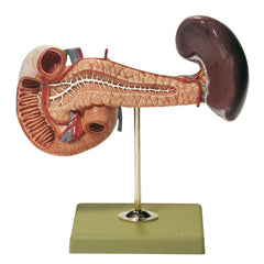 SOMSO Pancreas with Spleen and Duodenum