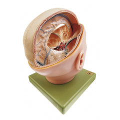 SOMSO Proportions of the Dura Mater