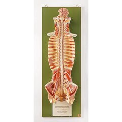 SOMSO Spinal Cord in the Spinal Canal