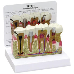 Teeth (oversize) Model