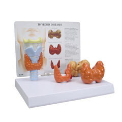 Thyroid Model - set of 4