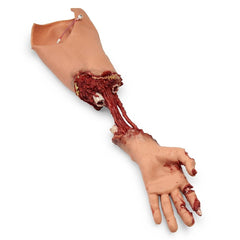 Trauma Bleeding Arm for Advanced SMART STAT