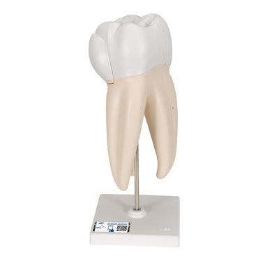 Upper Triple-Root Molar Model, 3-part