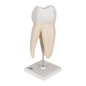 Upper Triple-Root Molar Model, 3-part