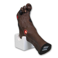 'Wilma' Wound Foot Model, Dark