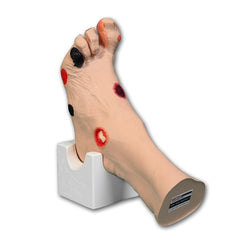 'Wilma' Wound Foot Model, Light